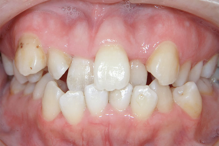 Before image